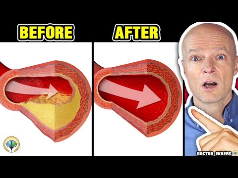 Only A Glass Of This Juice... Reverse Clogged Arteries &amp; Lower High Blood Pressure - Doctor Reacts
