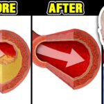 reverse clogged arteries & lower high blood pressure with a
