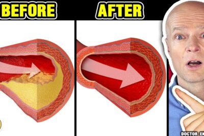 Reverse Clogged Arteries & Lower High Blood Pressure with a Glass
